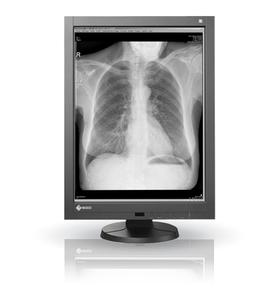 EIZO RadiForce GX340, product photo