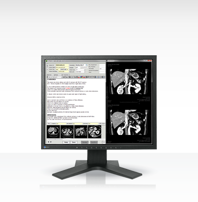 EIZO RadiForce MX194, product photo