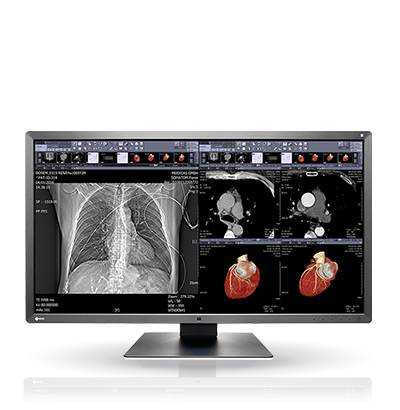 EIZO RadiForce MX315W, product photo