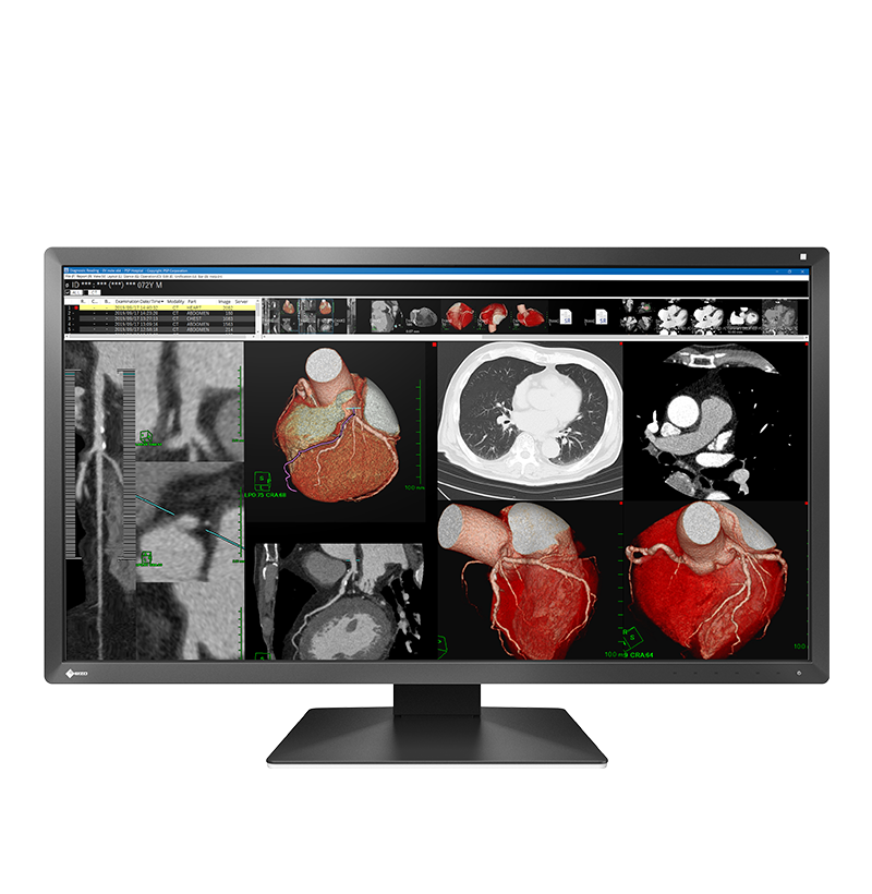 EIZO RadiForce MX317W, product photo