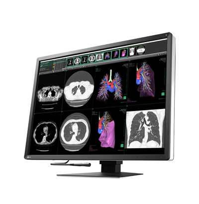 EIZO RadiForce RX1270, product photo