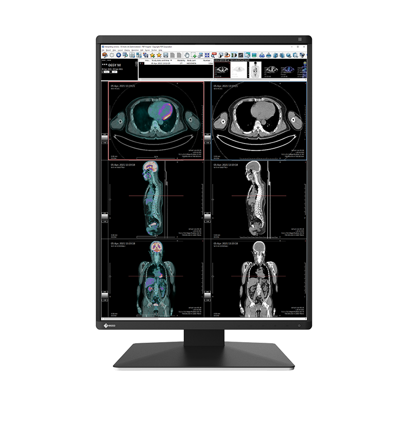EIZO RadiForce RX370, product photo