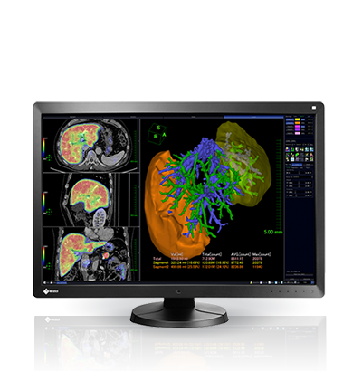 EIZO RadiForce RX650, product photo