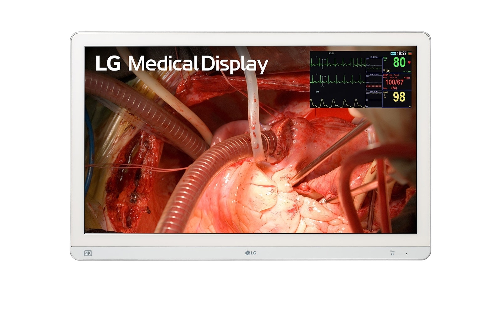 LG 27″ 4K Mini LED surgical monitor, front product view