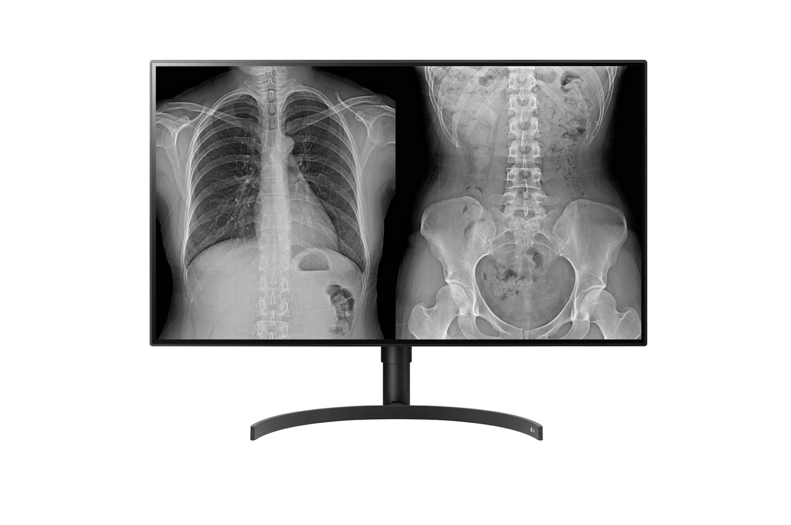 LG 32HL512D 32″ IPS clinical reporting and home reporting monitor, front product view