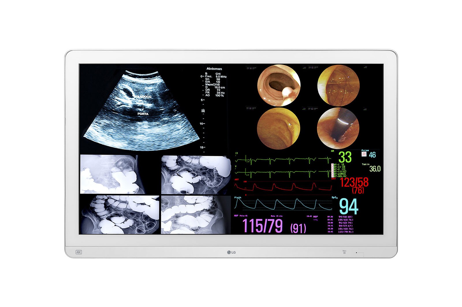 LG 31.5″ 4K IPS surgical monitor, front product view